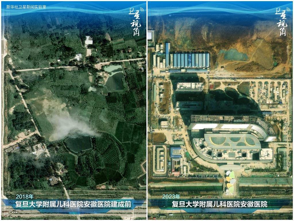 2023年與2018年相比，復旦大學附屬兒科醫(yī)院安徽醫(yī)院從一片荒地到建成投用。該項目是安徽省在長三角一體化高質(zhì)量發(fā)展衛(wèi)生健康領(lǐng)域的重大項目，也是安徽首批落地的國家區(qū)域醫(yī)療中心。